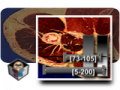 Thumbnail for version as of 16:18, 9 December 2008